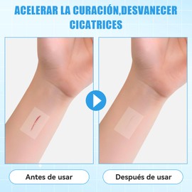 Vendaje para Tatuajes, Vendaje Impermeable, Parches para Tatuajes, Cinta de Medicamentos Transpirable, Cinta Transparente Impermeable, Película Protectora de la Piel para Médico, Herida, Natación, Ducha(10cm*10m)