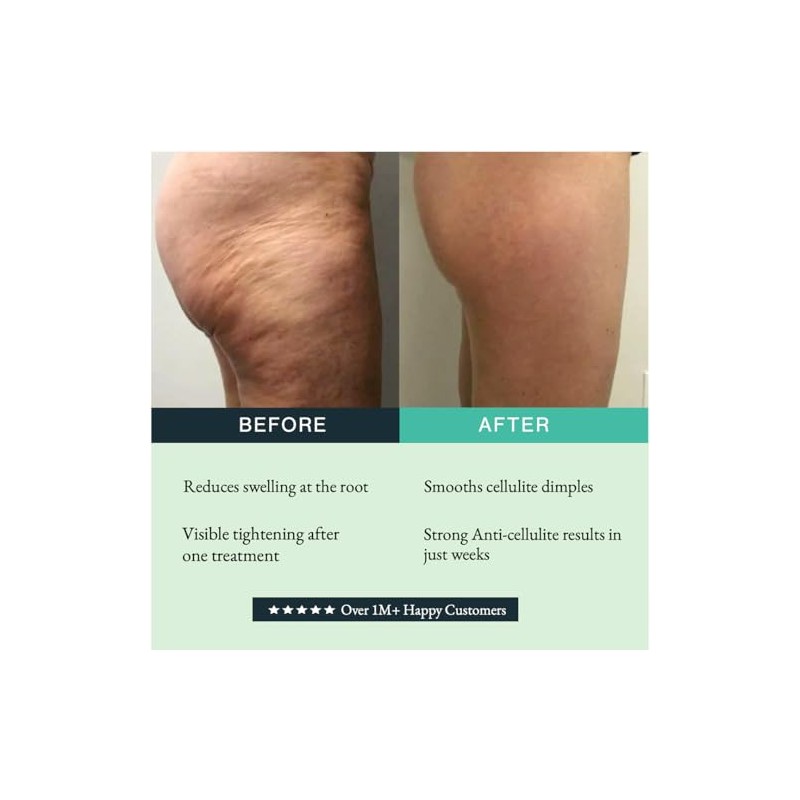 GUAM Crema Liporeductiva Anticelulitis