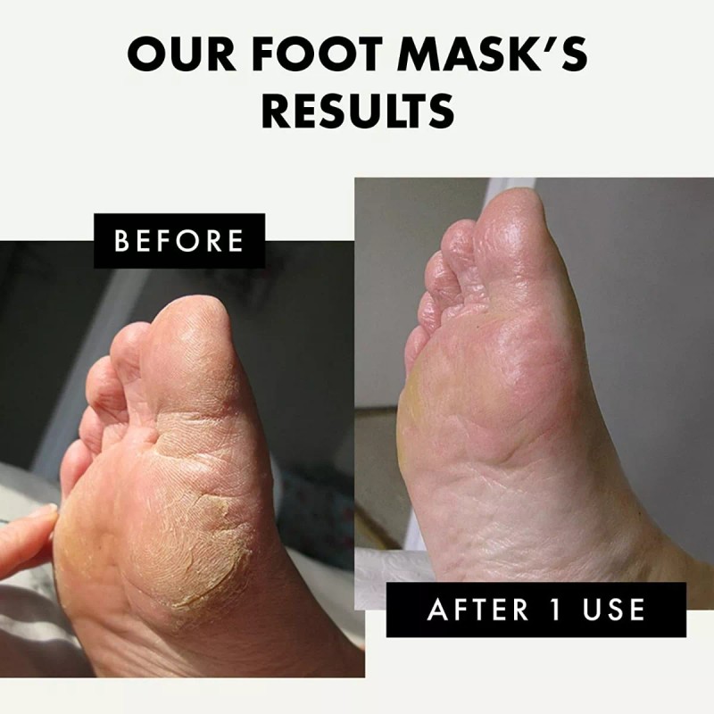 Eclat Skincare. Mascarilla Exfoliante Para Pies.