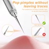 IKOPFLN 1 piece blackhead remover, pimple removal tool, comedone squeezer,