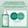 Skin1004 Kit Centella Madagascar Antiacné Tea-trica 4 Pzs