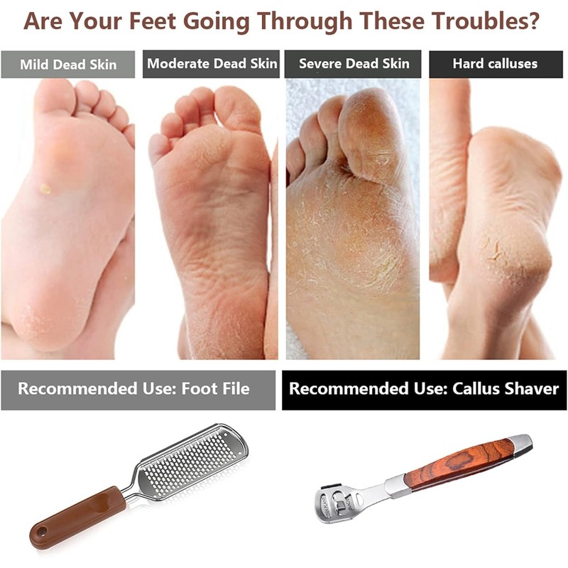 Foot File & Callus Remover,Heavy - Duty Pedicure Tool with