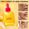 Suero Vitamina C Equal Berry Iluminador 30 Ml