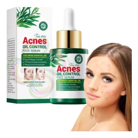 Sérum Universo en Linea Ácido Salicílico Té Verde Control Acné Facial 30mL