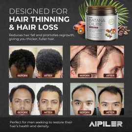 Aceite Para El Crecimiento Del Cabello Aipiler Batana Oil Co