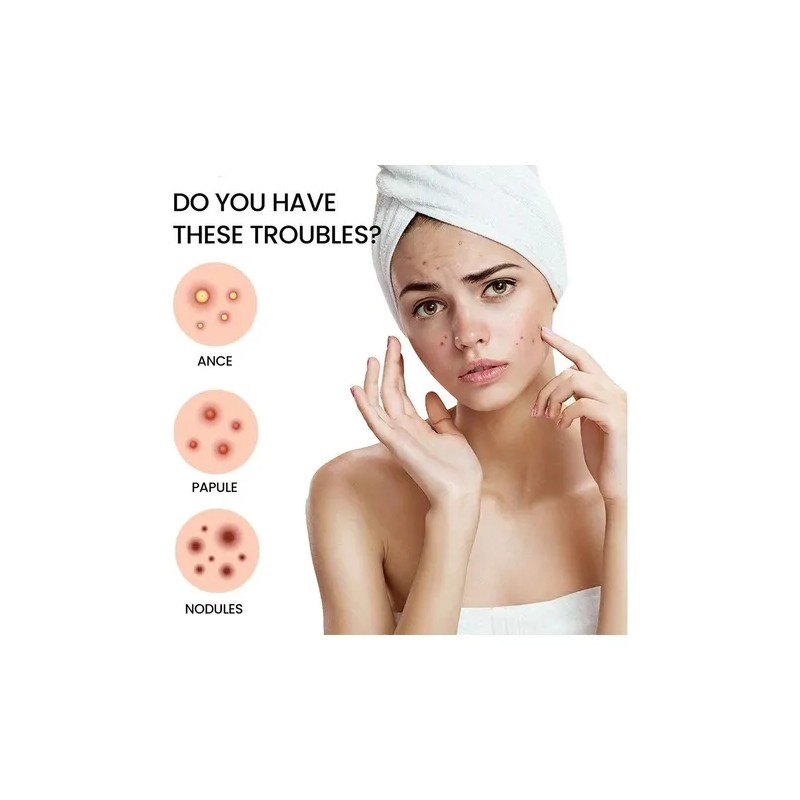 360pcs Breathable Circle Acne Patch Skincare Rapid