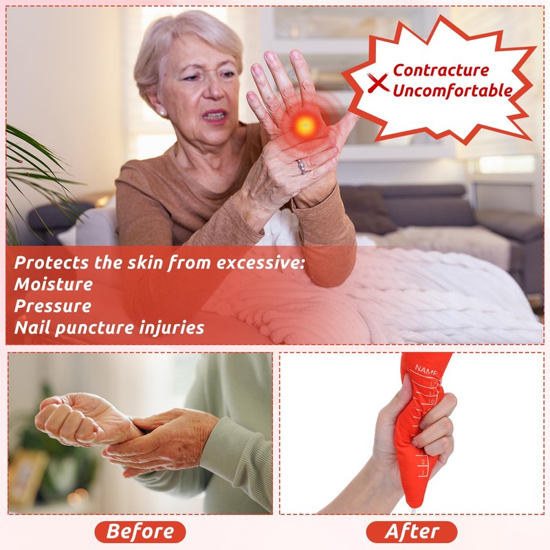 Skylety 3 Pcs Carrot Hand Contracture Orthosis Palm Protector Carrot