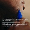 Harry Gel Corrector Manchas Paquete