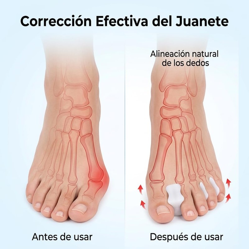 Separadores de Dedos de Gel, 6 Piezas