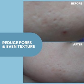 Eva Naturals Skin Firming Serum (1oz) - Day or Night Serum Instantly Firms Loose Skin and Refines Wrinkles - With Plant-Derived Amino Acids, Hyaluronic Acid, Peptides and Niacinamide - Premium Quality