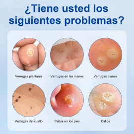 Crema Verrugas Elimina Eficazmente Cuida Piel 20g Neutra