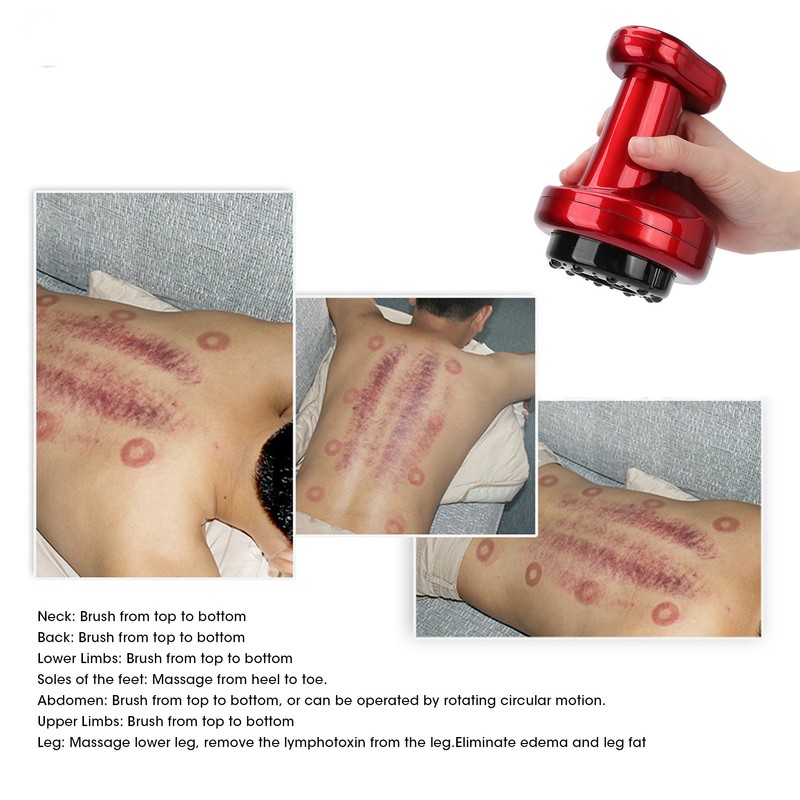 Rechargeable Electric Body Scraping Machine Negative Pressure 9 Gears Cupping