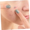 Ipetboom 2 Sheets Pimple Sticker for Patches Facial Patches Stickers