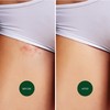 Nad's Nad's Soothing Ingrow Solution, Ingrown Hair Reduction, Treatment for