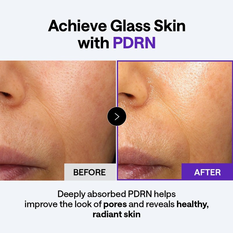 MEDIHEAL PDRN Derma Cream for Glass Skin & Pore Care