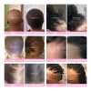 Vitaminas Crecimiento Cabello Tru Bloom