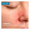 Ducray Kelual Ds Crema Calmante Piel Sensible Roja Escamas