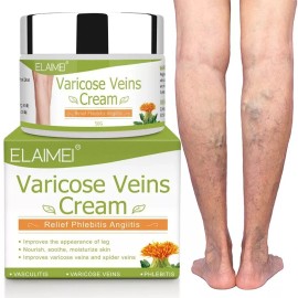 Varicose Veins Treatment Crema Para Las Varices Borra Las Venas Varicosas Elimina Verrugas ys Arañitas ys