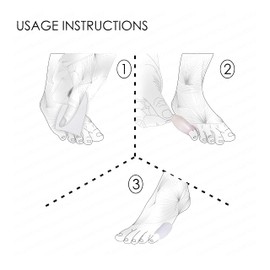 Pedimend™ Little Toe Bunion Cover Pads | Bunionette Protector Guard Sleeve | Pinky Toe Gel Support | Provides Tailors Bunion Relief | Cushions Separates Straightens Toe Alignment