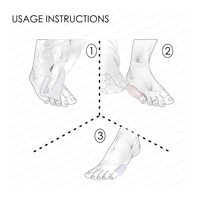 Pedimend™ Little Toe Bunion Cover Pads | Bunionette Protector Guard