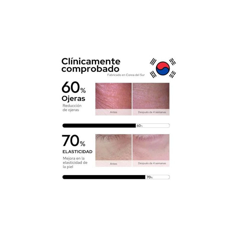 MIZON Parches para Ojos de Hidrogel (Gold) Antiojeras y antibolsas