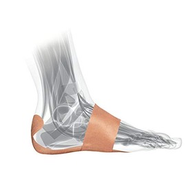 Mueller 56337 Plantar Fascial Support Tape for Arch & Heel Support Plantar Pain