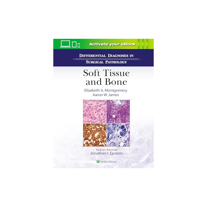 Differential Diagnoses in Surgical Pathology: Soft Tissue and Bone