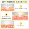 Psoriasis Cream 20g,Intensive Moisturising Cream for Very Dry, Flaky Skin