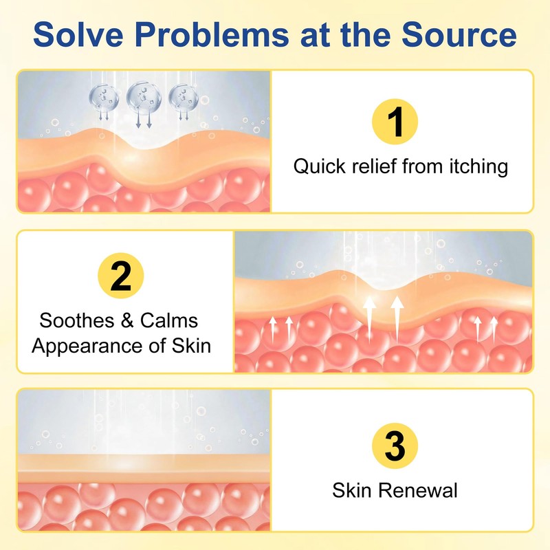 Psoriasis Cream 20g,Intensive Moisturising Cream for Very Dry, Flaky Skin