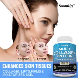 Soomiig Multiple collagen capsules, types I,II,III,V, and X-support skin, hair,and nails
