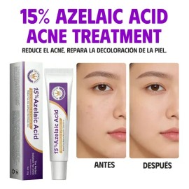 Acido Azelaico Suero Facial 15% Hialurónico Crema Hidratante