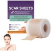 Cinta de silicona para cicatrices DMMYBJ – Reduce y previene