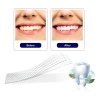 Tiras Blanqueadoras Dentales White Piezas Antideslizantes