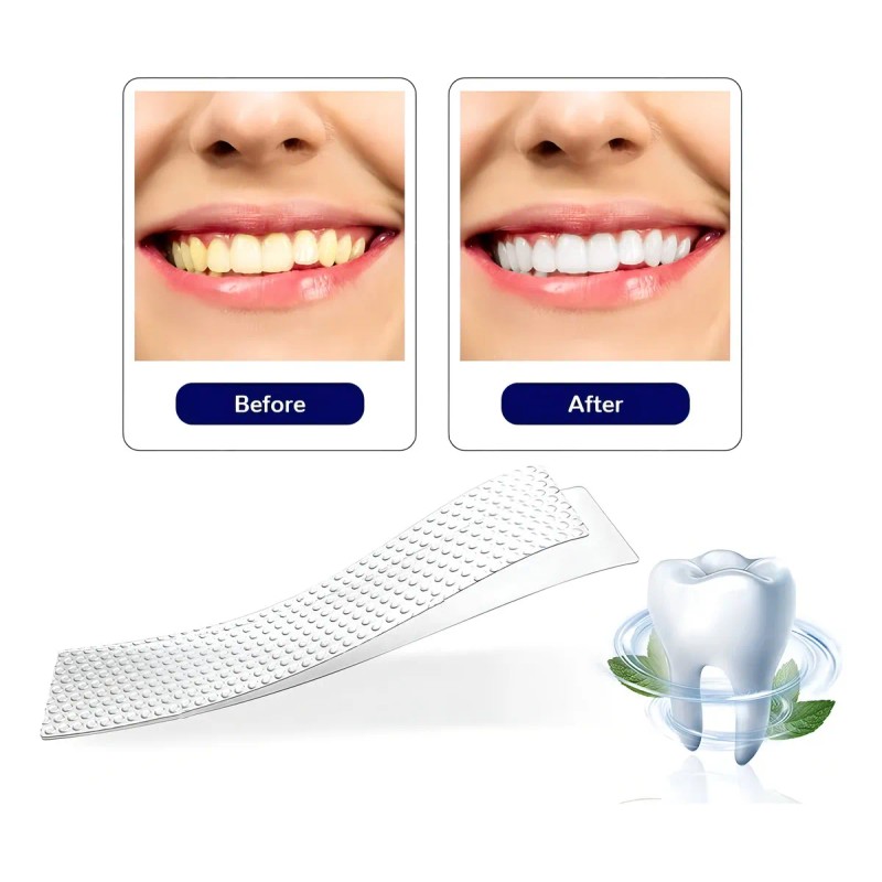 Tiras Blanqueadoras Dentales White Piezas Antideslizantes