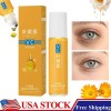 Unbranded 10ml Lutein Eye Oil Anti-wrinkle Moisturizing VC Oil Ball