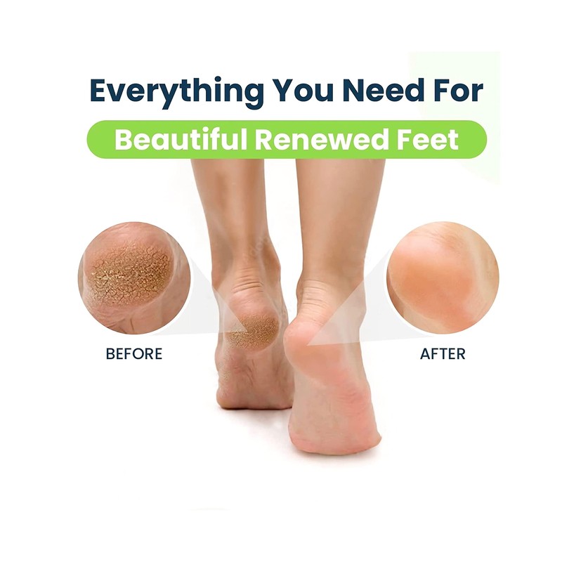 Foot File Callus Remover for Feet - Double Sided Emery