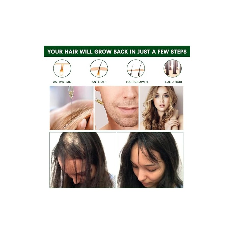 Aceite de Romero para El Cabello,30ml Rosemary Oil for Hair
