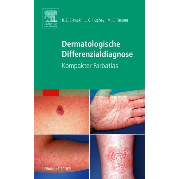 Dermatologische Differenzialdiagnose: Kompakter Farbatlas