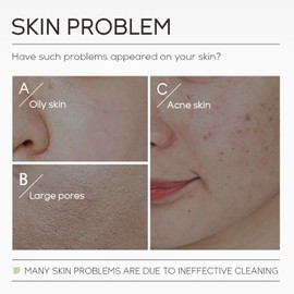 ARCHIDATE Mugwort Clay Mask, Mugwort Anti Pores & Acne Clay Mask, Deep Clean Pores of Excess Oil, Reduce Blackheads Acne, Shrink Pores, Moisturize and Sooth Skin, Suitable for All Skin Types