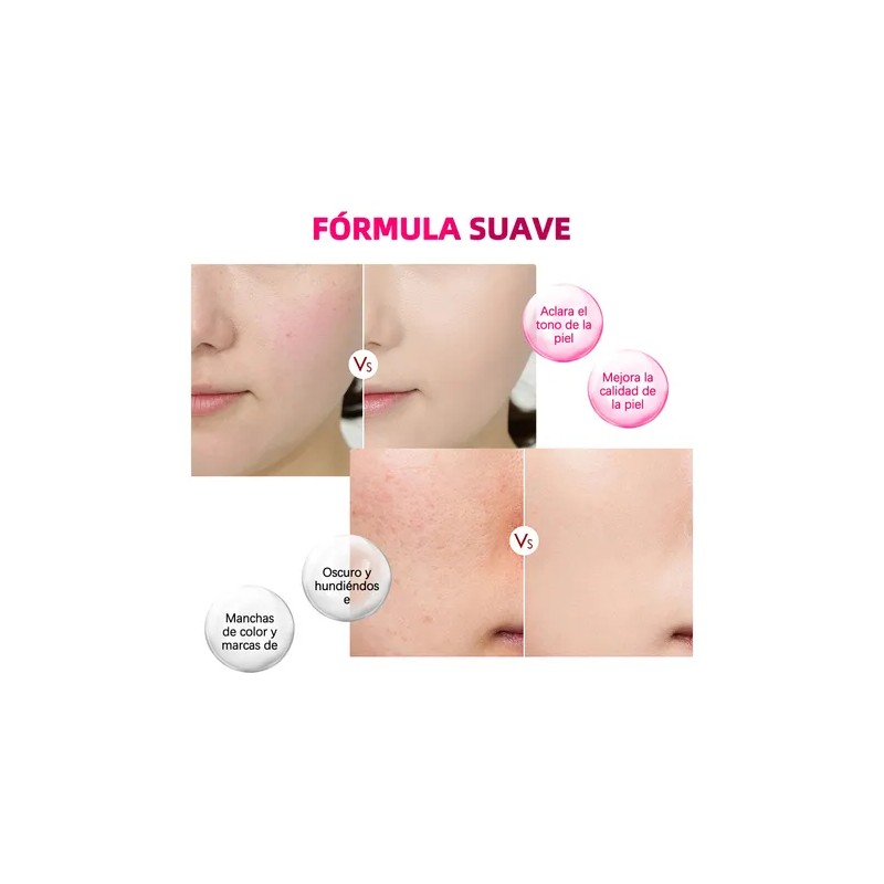 Crema Antimanchas Despigmentante Aclarante Blanqueador