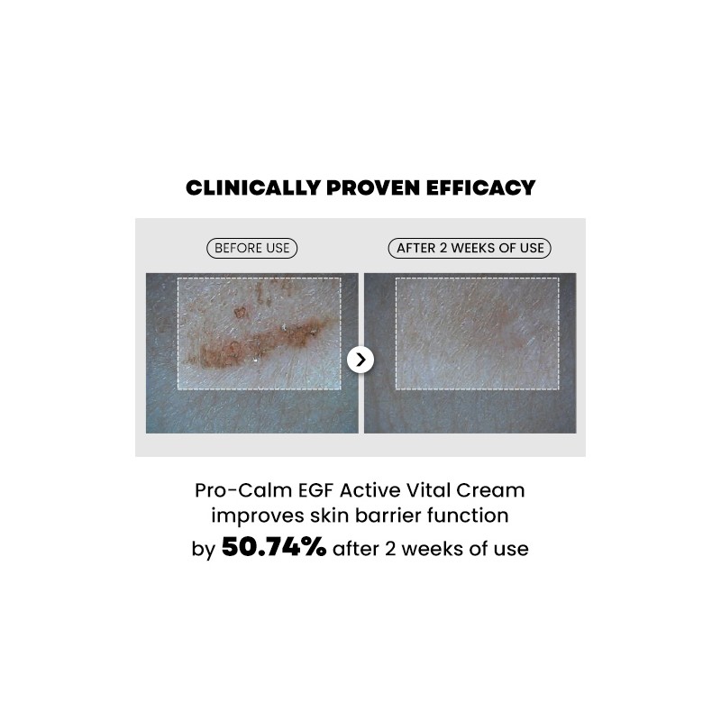 PRO-CALM [PRO-CALM]EGF Active Vital Cream 20ml