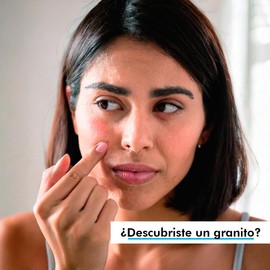 Simple Pimple - Pickel Pflaster, Pimple Patches mit Salicylsäure, Teebaumöl, Akne, unsichtbare Pickelpflaster, Behandlung für Pickel und Mitesser, Hautpflege (36)