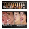 FrontMan Lot Of 4 FRONTMAN Fade, Men's Acne Concealer With