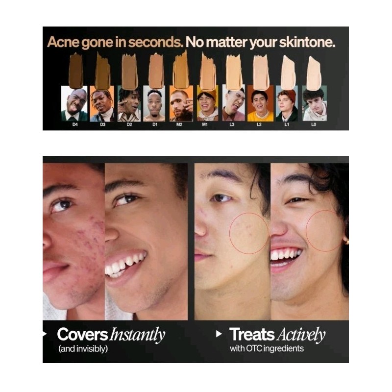 FrontMan Lot Of 4 FRONTMAN Fade, Men's Acne Concealer With
