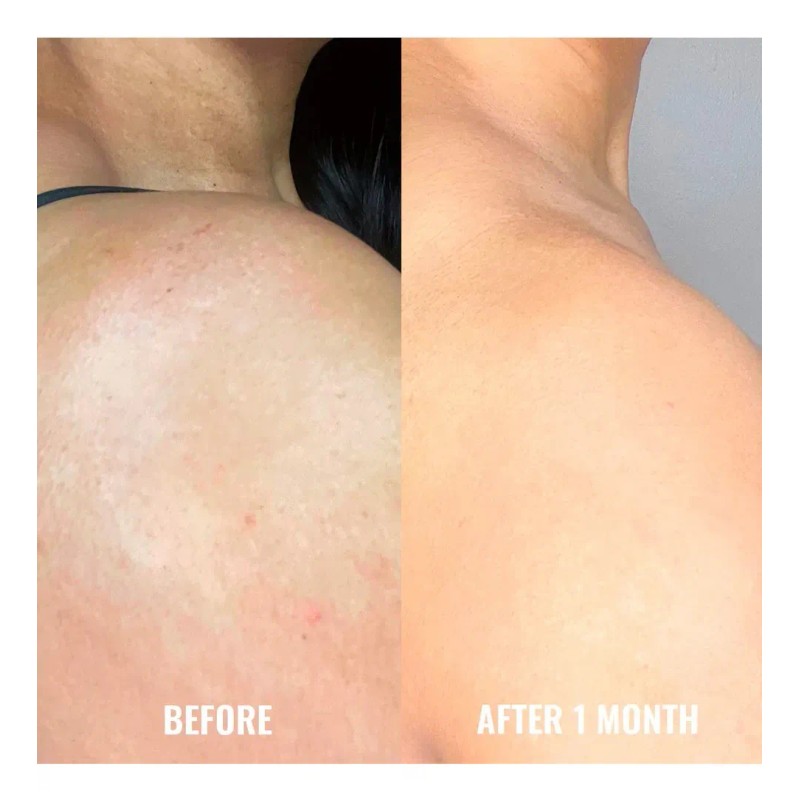 Suero Corrector De Manchas Para Cuerpo Good Molecules 120 Ml
