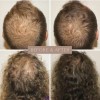 Sérum Para Crecimiento De Cabello Y Cuero Cabelludo 20ml