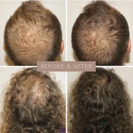 Sérum Para Crecimiento De Cabello Y Cuero Cabelludo 20ml