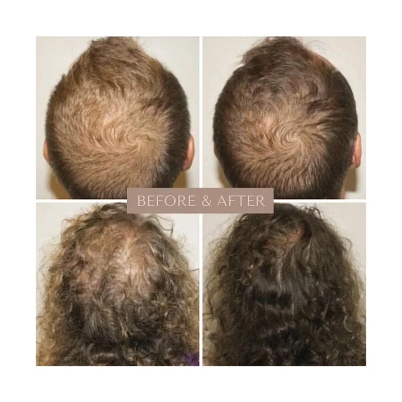Sérum Para Crecimiento De Cabello Y Cuero Cabelludo 20ml