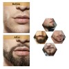 Apolo Cosmetics Para Barba, Estimulante De Barba Apolo,2