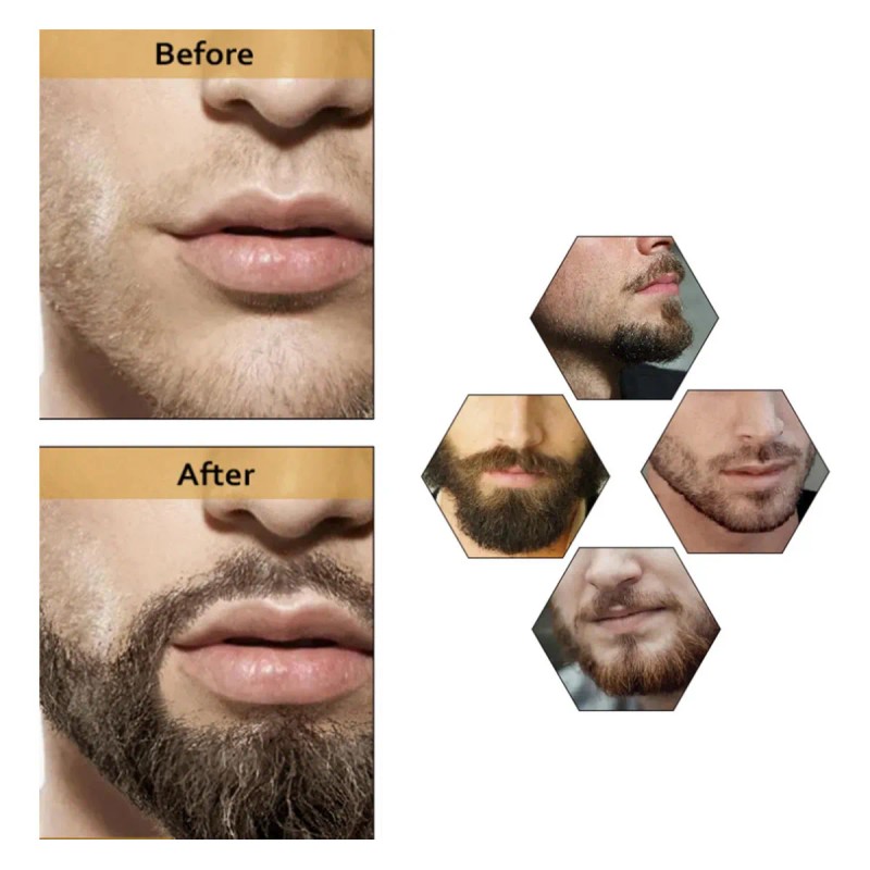 Apolo Cosmetics Para Barba, Estimulante De Barba Apolo,2